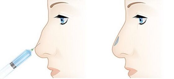 This process allows you to adjust various issues