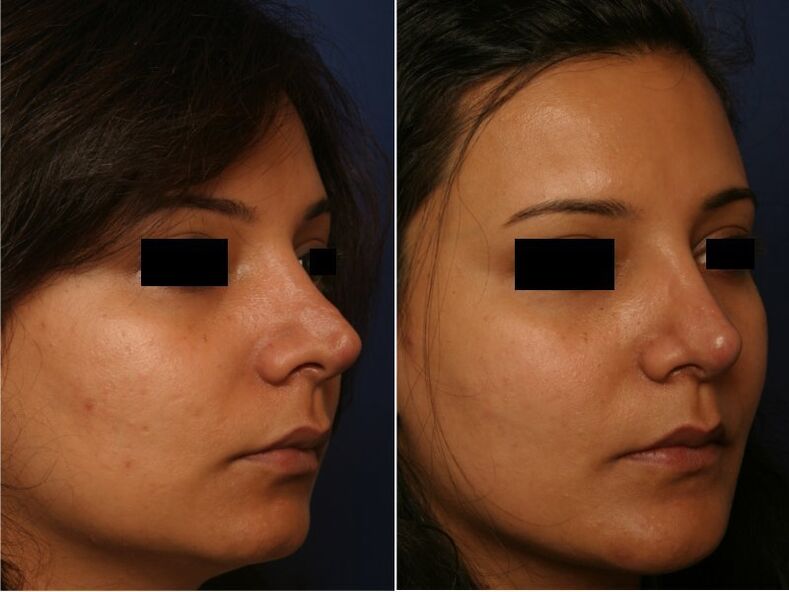 plastic surgery results