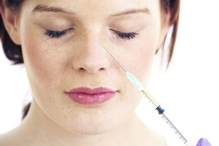 Non-surgical filler rhinoplasty