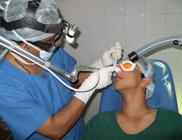 Use laser scalpel to correct septum