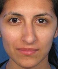 Irregular nose shape a reason for plastic surgery