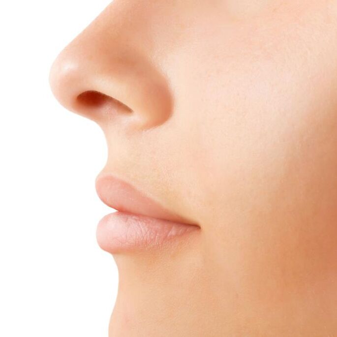 Open rhinoplasty surgery results