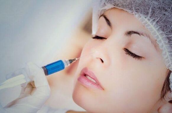 Filler injection for nose correction