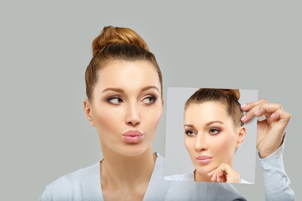 Woman face before and after rhinoplasty